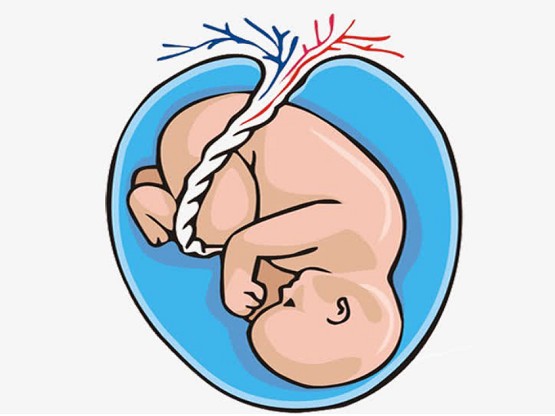 新世纪妇儿产科专家范玲谈为什么会得妊娠期糖尿病