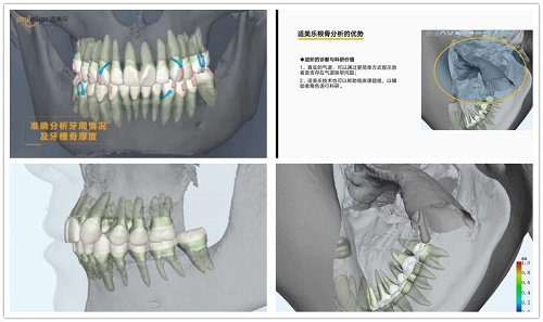 适美乐与瑞尔集团达成战略合作,共谱数字化安全矫正新篇章 适美乐与瑞尔集团达成战略合作,共谱数字化安全矫正新篇章