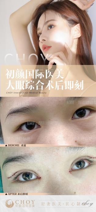 成都初颜国际医美正规吗？评判标准是什么？