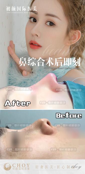 成都初颜国际医美正规吗？评判标准是什么？