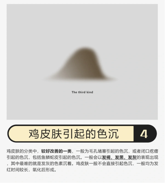 你是哪种鸡皮肤？找对方法成功上岸！