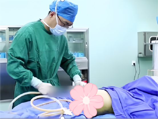 杭州星光丽格汪峰院长又获批一项专利！让“马甲线体雕”更好塑形