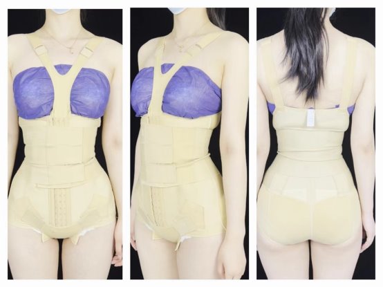 杭州星光丽格汪峰院长又获批一项专利！让“马甲线体雕”更好塑形