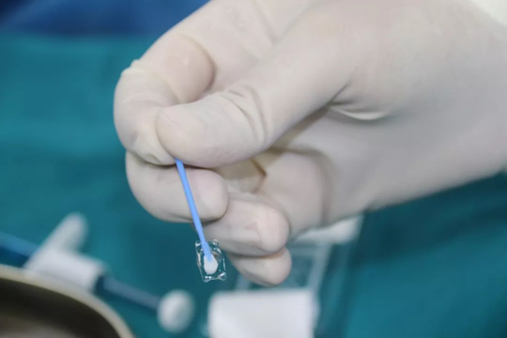 眼科员工告诉你?ICL晶体手术大实话