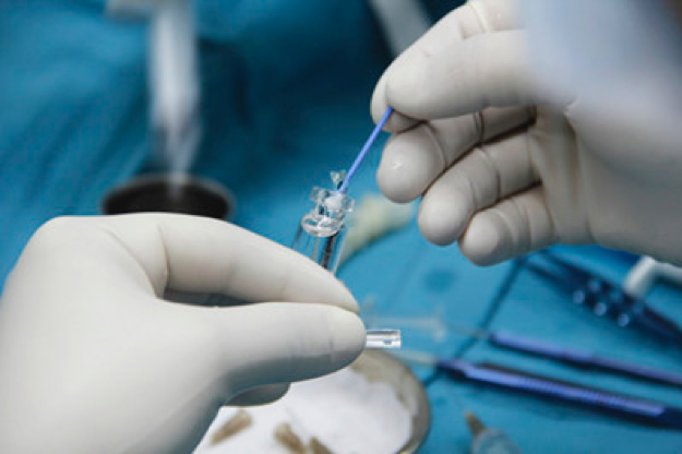 眼科从业者近视手术大实话：为何成都各家眼科医院ICL手术价格差距大