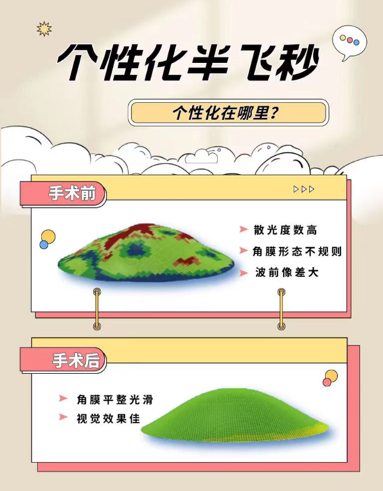 成都眼科医院个性化半飞秒近视手术，“个性”在哪里？