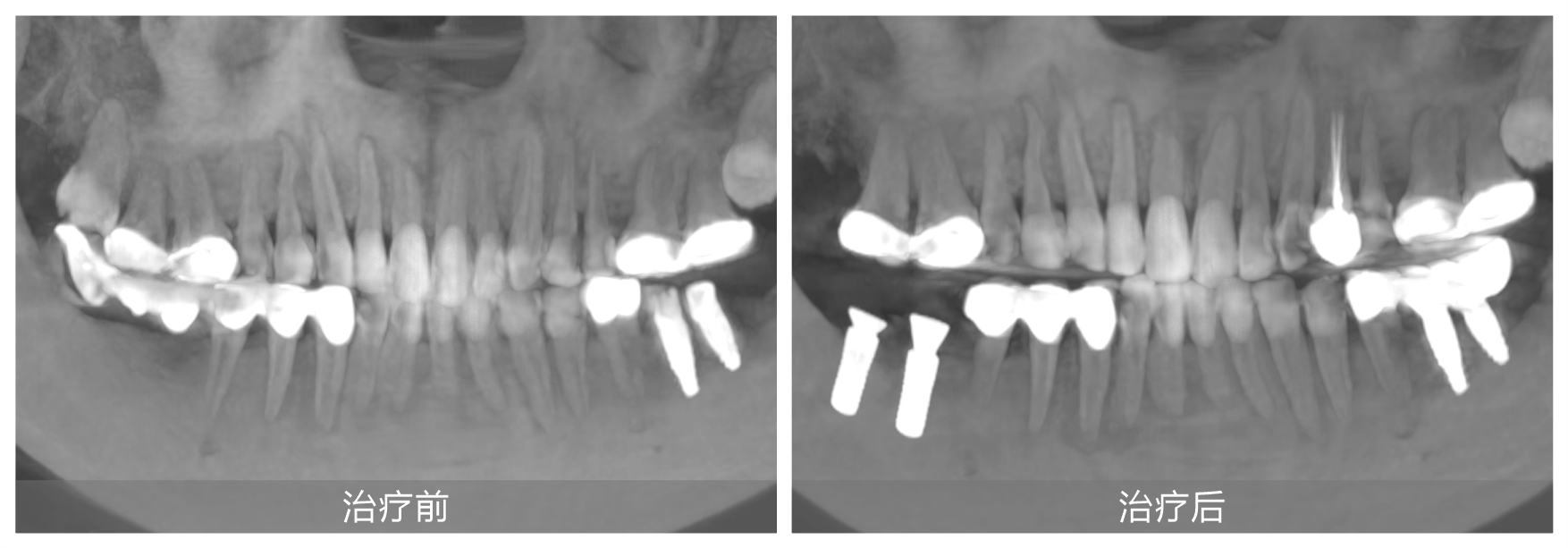 高调发帖表白医生，看牙“铁粉”主动为“偶像”打CALL！