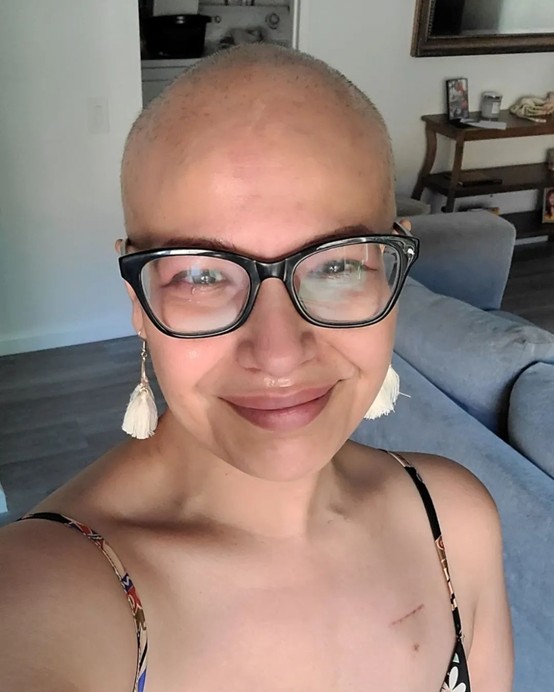 三阴性乳腺癌患者:在希望之城成功获治后绽放新生 三阴性乳腺癌患者:在希望之城成功获治后绽放新生