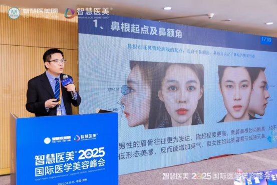 米扬丽格夏正义院长：解析男性隆鼻美学设计，引领男性美鼻潮流