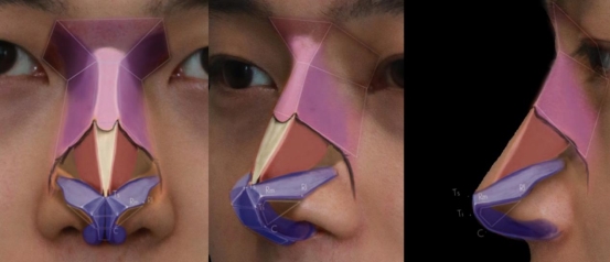 米扬丽格夏正义院长：解析男性隆鼻美学设计，引领男性美鼻潮流