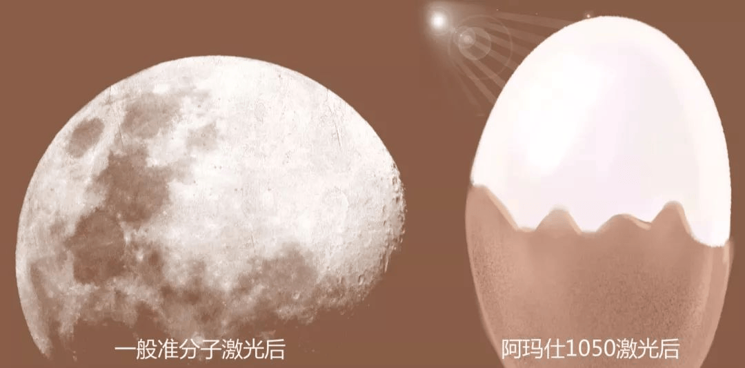 深圳近视手术怕踩坑？4步教你挑出靠谱眼科医院 