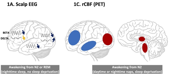 为什么睡一觉还是累?Nature Neuroscience揭示大脑真正的“恢复模式” 为什么睡一觉还是累?Nature Neuroscience揭示大脑真正的“恢复模式”
