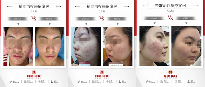 医保定点有保障,在家门口对接北京皮肤科专家 医保定点有保障,在家门口对接北京皮肤科专家