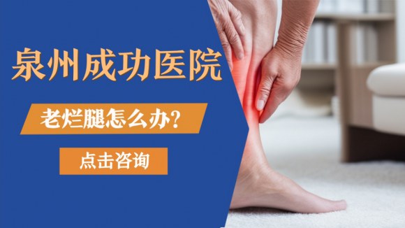 泉州静脉曲张老烂腿去哪治疗好?泉州成功医院中医药离子渗透调理下肢血管疾病 泉州静脉曲张老烂腿去哪治疗好?泉州成功医院中医药离子渗透调理下肢血管疾病