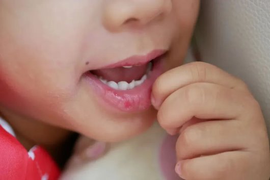 为什么我们需要用润唇膏,不止是为了保湿! 为什么我们需要用润唇膏,不止是为了保湿!